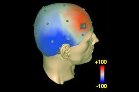 Über den Stirnbereich induzierte Gamma-Schwingungen führen zu Klarträumen.
© Voss et al. / nature.com