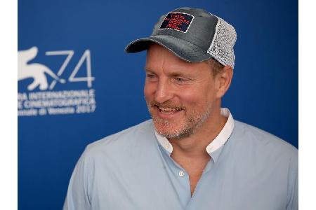 Woody Harrelson (57) litt als junger Mann unter Akne. Nach dem Hinweis, wenn er auf Milch verzichten würde, hätte er keine P...
