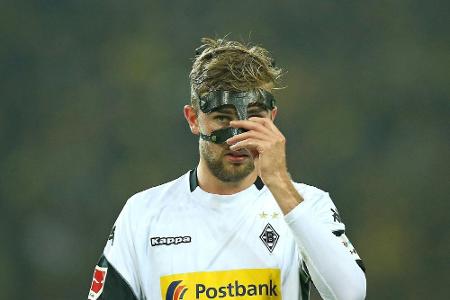Brummschädel des Tages: Christoph Kramer (Borussia Mönchengladbach) Brummschädel des Tages: Christoph Kramer (Borussia Mönchengladbach)