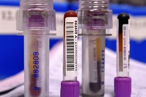 Dopingexperte Thevis: "Anti-Doping-Strategie hat nicht versagt"