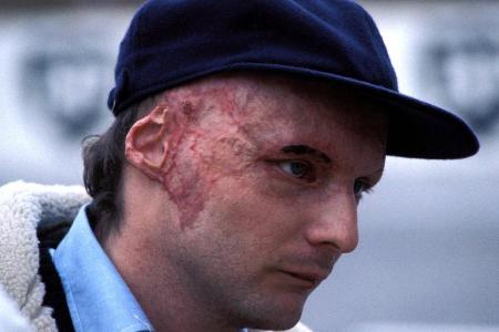 Für Lauda beginnt im Krankenhaus Mannheim ein Kampf ums Überleben – den er gewinnt. Mehr noch: Nur vier Wochen nach dem Horr...