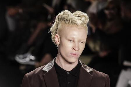 Shaun Ross gilt als erstes professionelles Albino-Model. Der New Yorker ist Afroamerikaner, doch seine Haut kann keine Farbp...