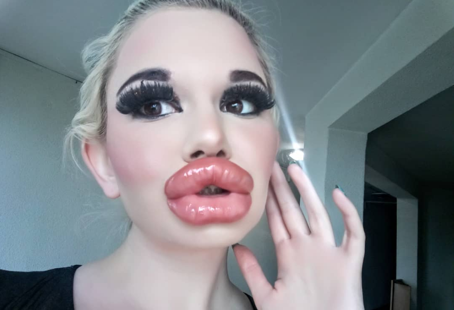 Diese Frau will die dicksten Lippen der Welt - freenet.de