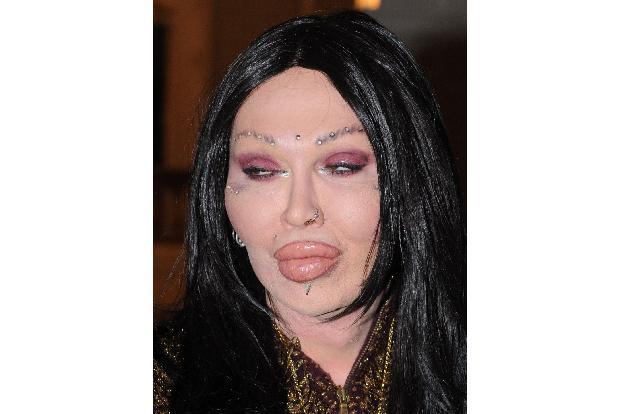 Schönheit, op beauty, wahn, misslungen