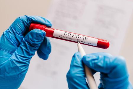 COVID-19 Test ist seit 8. August für Rückkehrer aus Risikogebieten verpflichtend