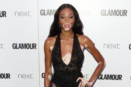 Ihr Makel ist ihr Markenzeichen: Model Winnie Harlow (23) wurde durch ihre Pigmentstörung erst zum Star. Ihre Haut weist am ...