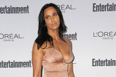 Ein weiteres Model mit Schönheitsmakel: Den Arm von Padma Lakshmi (47) ziert eine lange, große Narbe.