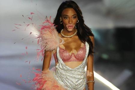 Winnie Harlow (24) schrieb Geschichte: Als erstes Model mit Vitiligo (Weißfleckenkrankheit) lief sie über den 