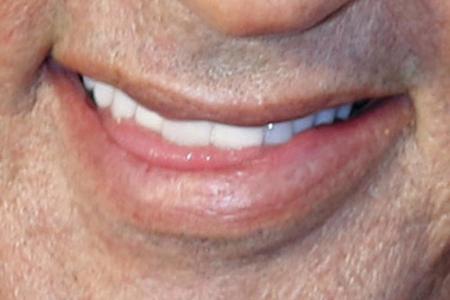 Relativ einfach: Dieses schiefe Lachen kann nur einem gehören.