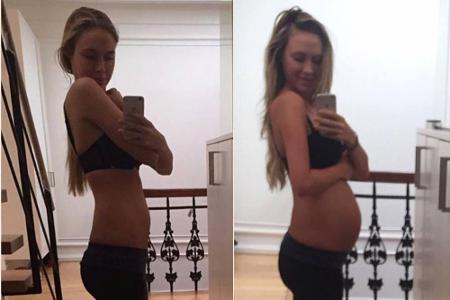 Model und Moderatorin Alena Gerber ist mit ihren 27 Jahren zwar im besten Schwangerschaftsalter. Trotzdem überraschte sie mi...