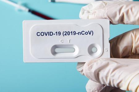 Bald schon sollen Schnelltests zur Verfügung stehen, die auch von Laien durchgeführt werden können. Bald schon sollen Schnelltests zur Verfügung stehen, die auch von Laien durchgeführt werden können.
