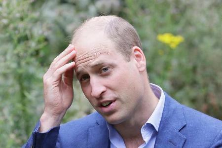 Eine offenbar entzückende Glatze: Prinz William hat trotz seiner jungen Jahre nicht mehr viel Haarpracht zu bieten.