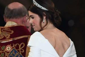 Prinzessin Eugenie zeigt ihre Narbe: "Lasst uns stolz darauf sein"