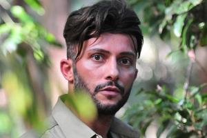 Domenico De Cicco steht zu seiner Haartransplantation