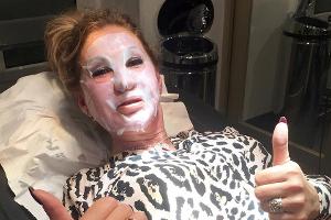 Vampir-Lifting für Carmen Geiss: "Viel schonender als Botox"