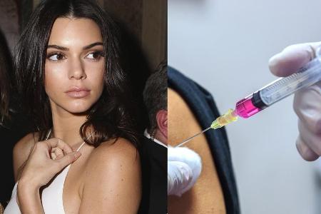 Auch Kendall Jenner soll sich einer Schönheitsbehandlung unterzogen haben