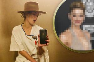 Amber Heard: Sexy Klinik-Post nach Knochenbruch