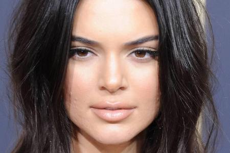 Von ihrer unreinen Haut lässt sich Kendall Jenner nicht beirren