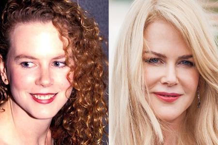 Man sieht es: An Nicole Kidman ist vieles nicht mehr natürlich