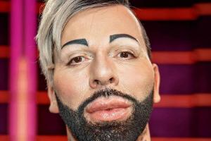 Erneuter Schönheitseingriff bei Harald Glööckler