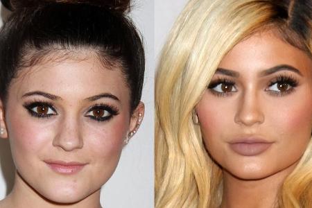 Kylie Jenner fand ihre Oberlippe zu schmal (2012, l.), heute sieht sie so aus (r.)