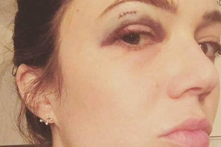 Selfies gehen immer: Mandy Moore zeigt ihr blaues Auge Selfies gehen immer: Mandy Moore zeigt ihr blaues Auge