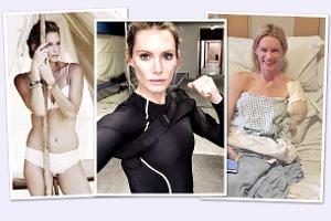 Milla Jovovichs Stuntfrau verliert ihren Arm