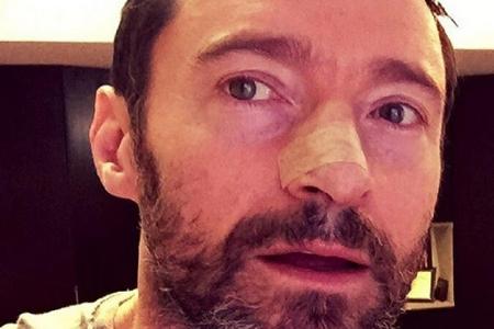 Hugh Jackman mit Pflaster: Das Resultat der jüngsten Hautkrebs-OP des Stars