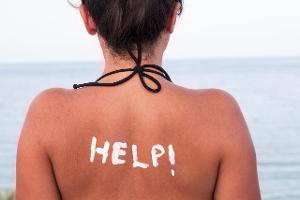 After Sun: Das hilft bei Sonnenbrand