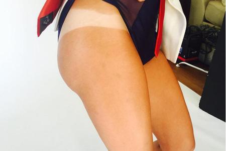 Kaley Cuoco-Sweeting zeigt die Schattenseiten eines Sonnenbades