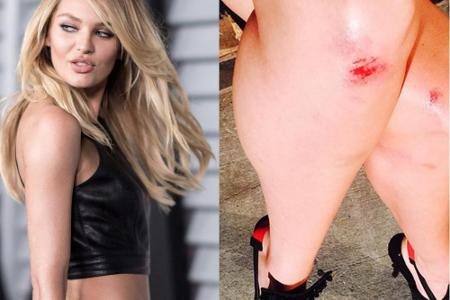 Candice Swanepoel: Kleine Kratzer nach dem Sturz auf der Fashion-Show Candice Swanepoel: Kleine Kratzer nach dem Sturz auf der Fashion-Show