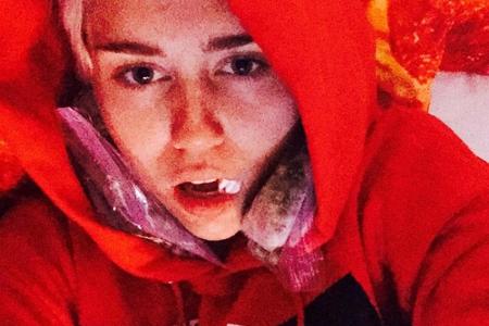 So leidet Miley Cyrus, nachdem ihr fünf Zähne gezogen wurden auf Instagram