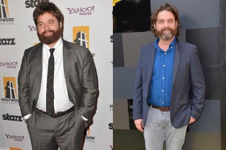 Zach Galifianakis (47) ist kaum wiederzuerkennen: Der Schauspieler, der vor allem als 