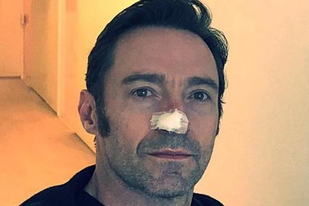 Hugh Jackman nach der Operation