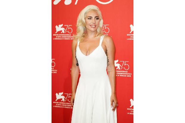 Das hinterließ Spuren: Aufgrund des jahrelangen Färbens leidet Gaga jetzt unter Haarverlust. Allerdings weiß sie sich zu hel...