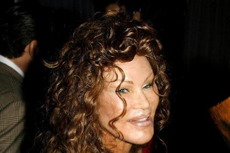 Die New Yorker Millionärin Jocelyn Wildenstein (79) ist bekannt für ihre ausufernden Schönheits-OPs.