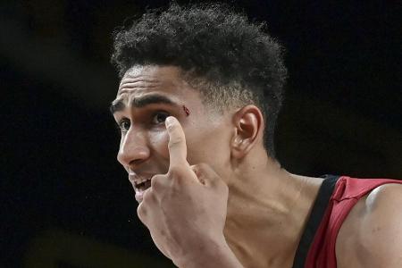 EuroLeague: Alba kassiert Pleite gegen den Titelverteidiger