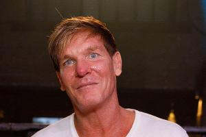 "Goodbye Deutschland"-Star Steff Jerkel zeigt seine Hautkrebs-Narbe