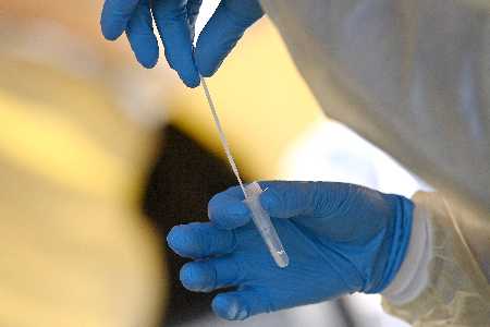 PCR-Test nur noch mit offiziellen positiven Schnelltest