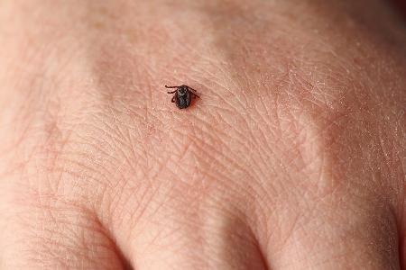 Zeckensaison hat begonnen: So schützen Sie sich vor den Parasiten Zeckensaison hat begonnen: So schützen Sie sich vor den Parasiten