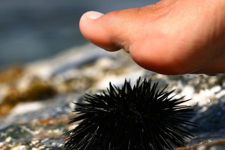 Augen auf beim Schwimmen: Diese Meeresbewohner sind gefährlich!
