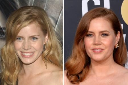 Amy Adams