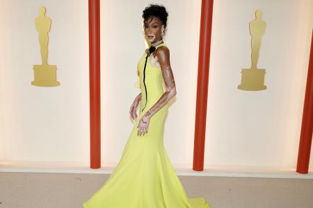Winnie Harlow