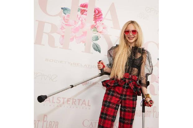 Theresia Fischer wird GNTM-Fans nicht nur als exzentrische Frohnatur im Gedächtnis bleiben, sondern auch als das junge Model, das seine Beine mit Hilfe einer schmerzhaften Prozedur über mehrere Jahre hinweg verlängern ließ. Von…