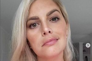 Angelina Kirsch: Job wegen ihrer Gesichtslähmung abgesagt