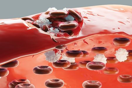 Arterie