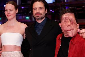 Entstellter Berlinale-Star Adam Pearson begeistert bei Premiere