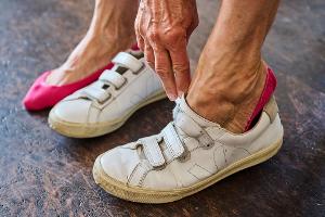 Charcot-Fuß bei Diabetes: Wenn Brüche unbemerkt bleiben