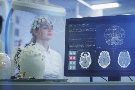 forschung in der neurologie