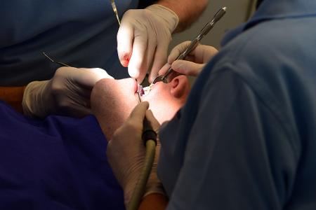 Neue Amalgam-Füllungen soll es nur noch in Ausnahmefällen geben. (Symbolbild) Neue Amalgam-Füllungen soll es nur noch in Ausnahmefällen geben. (Symbolbild)